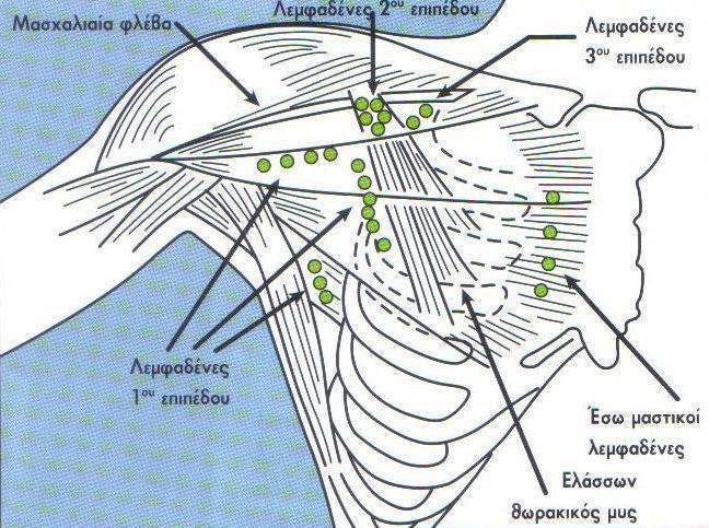 τα μέσα τη σφαγίτιδα φλέβα, προς τα έξω τον τραπεζοειδή μυ και προς τα κάτω την υποκλείδια φλέβα. Στον πυθμένα του τριγώνου υπάρχει ο πρόσθιος σκαληνός μυς ( Παπανικολάου, 2005 ).