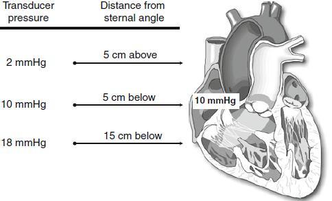 Καθετήρας Πνευμονικής Αρτηρίας (Swan-Ganz) Cardiovascular Hemodynamics: An introductory guide (2013)