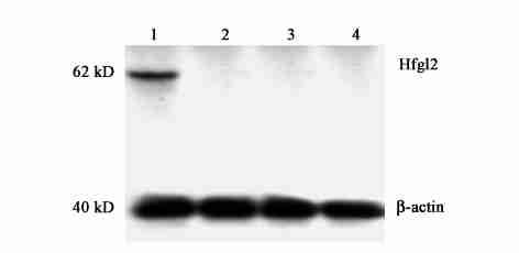 2 : hfgl2 SARS 133, CHO, hfgl2 2Gal, 4 p GL22Basic 1,, CHO, pcdna3112n 416 SPSS 4,N pcdna311 P < 0101,, N hfgl2 M S2 pcdna311 ( P > 0105) (Fig13), M S2 hfgl2 Fig 4 Real2time PCR analysis of