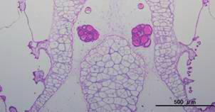 reduced or increased Colloid quality: homogeneous, heterogeneous, lacy or