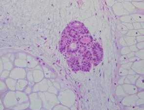 Trimming Dehydration Embedding by paraffin Slicing serial sections (5 7μm)