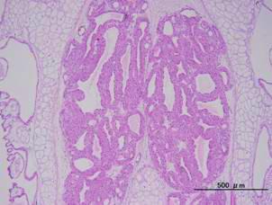 5.5.5 3.5.5 G G G3 G4 G5 G G G3 G4 G5 G G G3 G4 G5 Follicular cell hyperplasia Follicular cell hypertrophy