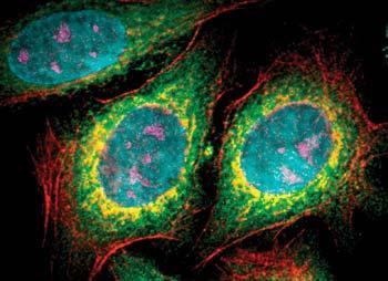 Kvantové bodky ako farbivá pre fluorescenčné merania QB sa vyznačujú vyššou stabilitou s porovnaní s chemickými fluorescenčnými markermi (farbivami).