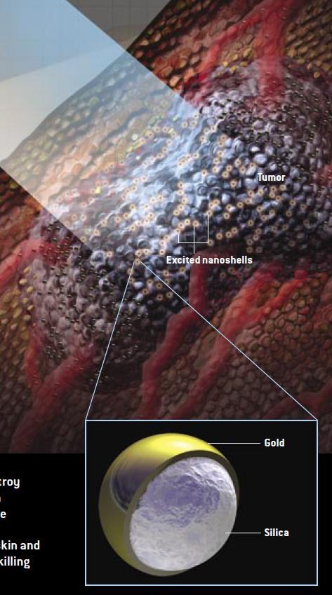 Aplikácie LPP Zviazané LPP (coupled) pre konštrukciu plazmónových vlnovodov SERS Surface enhanced Raman spectroscopy, až 10
