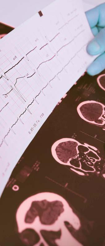 KEĎ TELO PRESTANE POČÚVAŤ, ČO MOZOG HOVORÍ SKORÁ DIAGNOSTIKA A VČASNÉ ZAHÁJENIE BIOLOGICKEJ LIEČBY JE KĽÚČOM K ŽIVOTU S DIAGNÓZOU SKLERÓZA MULTIPLEX Zhoršené videnie, slabosť, únava, strata kontroly