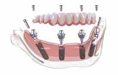 35 VIHRAVE TRZINKE Ženski pevski zbor Trzinke, Kulturno društvo Ivan Hribar Trzin ESTETSKO ZOBOZDRAVSTVO IMPLANTOLOGIJA ORALNA KIRURGIJA CEREC 3D PROTETIKA BELJENJE ZOB ORTODONTIJA ZOBNI RENTGEN 3D