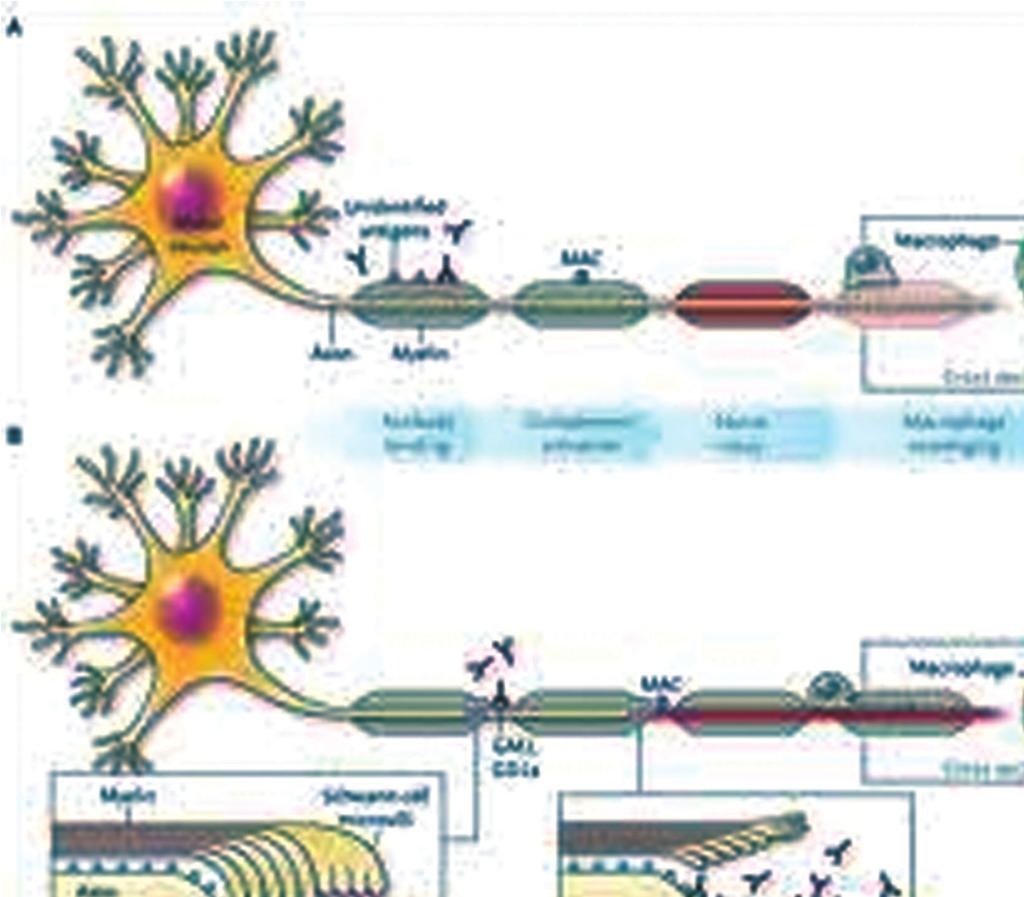 Autoprotilátky proti antigénom SOX1 a titin Klinické indikácie: Paraneoplastické neurologické syndrómy Antigén SOX1 proteín patriaci do skupiny SOXB1 proteínov - transkripčných faktorov, ktoré sú