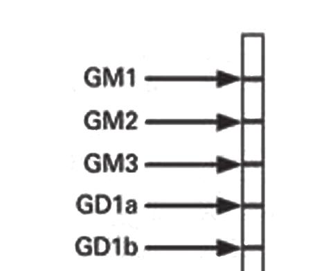 z nich, najčastejšie Campylobacetr jejuni, CMV, EBV, Haemofilus influenzae, Mycoplasma pneumoniae atd., sa môžu komplikovať výskytom zápalových neuropatií.