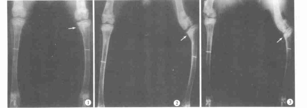 490 1 A 8 X, 2 A 16 X, 3 D 16 X, F ig. 1 Roen tgenogram of group A in the 8th week, light varus and shorten ing deformation can be seen in the r ight tibia ( ) F ig.