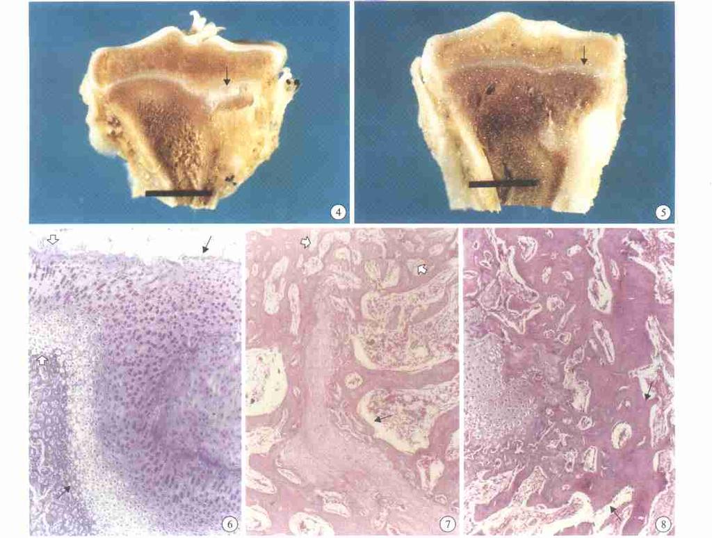 2003 17 6 491 4 A 2, 5 A 4, 6 A 2, ( ) (Ρ ),,, ( 40) 7 A 8, ( ), (Ρ ) (HE 40) 8 D 4, (HE 40) F ig. 4 Repa ir of epiphyseal plate defects( ) of group A in the 2nd week F ig.