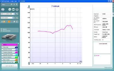Callisto Instructiuni de utilizare - RO Page 49 Vizualizare avansată Vizualizare simplă Butoanele Normal and reversed coordinate system (Sistem de coordonate normal şi inversat) vă permit să comutaţi