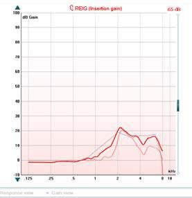 Callisto Kasutusjuhend ET Page 45 Single Graph (Üks graafik) võimaldab paigaldajal vaadelda binauraalseid mõõtmisi ühe graafikuna, asetades vasaku ja parema kõrva kõverad ülestikku.