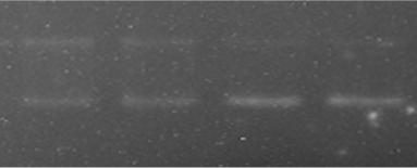 6 units τοποϊσοµεράση ΙΙ + 1000 µm 12f Εικόνα 32: Επίδραση του φυτικού κλάσµατος Vf 12f (400, 600, 800, 1000 µm) στην δράση της τοποϊσοµεράσης ΙΙ Για την µελέτη της ανασταλτικής δράσης του µορίου Vf
