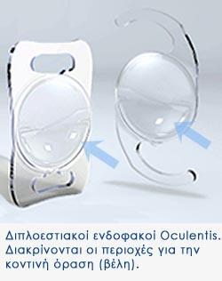 4. Οι διπλοεςτιακού ενδοφακού, ςχεδιϊςτηκαν για να