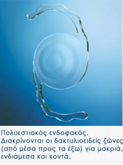 5. Οι πολυεςτιακού ενδοφακού, δημιουργόθηκαν με ςκοπό να ικανοποιόςουν τισ ανϊγκεσ εςτύαςησ ςε ακόμα