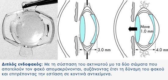 γ) δηπιός