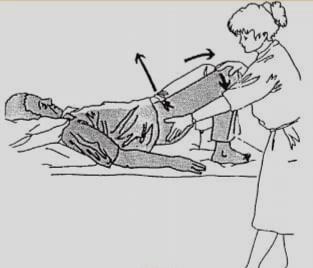 Μεταφορά στο κρεβάτι από τα πλάγια Ο ασθενής: ξαπλώνει με λυγισμένα γόνατα και τις φτέρνες κοντά στους