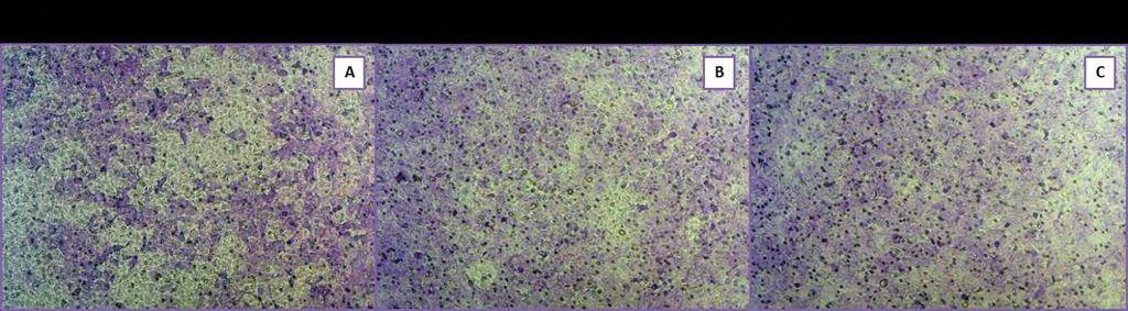 3.3.4. Μετανάστευση (Transwell assay) Τα κύτταρα DLD-1 επιλέχθηκαν να μελετηθούν περαιτέρω, όσον αφορά στις επιπτώσεις που θα είχε η υπερέκφραση των Uc160 ή Uc346 στη μετανάστευσή τους.