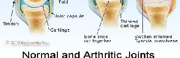 BRADIKINI INFLAMATORNI ODGOVOR CRVENILO BOL IRITACIJA EDEMI INFLAMATORNA