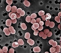 epimerizácia na glukózu glykolýza Metabolický proces