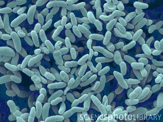 Oxidatívna fermentácia octové kvasenie Acetobacter aceti Acetobacter