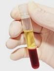 23 Το αίμα θεωρείται από τους περισσότερους ερευνητές
