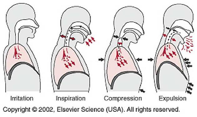 Παθοφυσιολογία 3 φάσεις Εισπνευστική φάση : εισπνευστική προσπάθεια Φάση συμπίεσης : Δυναμική εκπνευστική προσπάθεια έναντι