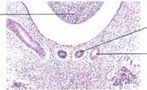 Κεφάλαιο 1 Εμβρυολογία - Ανατομία Ουροποιογεννητικού Συστήματος 5 Τοίχωμα παχέος εντέρου Παραμεσονεφρικός πόρος Μεσονεφρικός πόρος Εικόνα 1.3 Φωτομικρογραφία τομής ανθρώπινου εμβρύου.