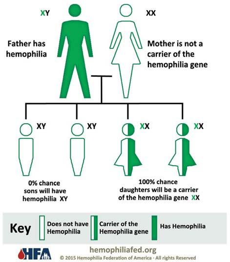 Κεφάλαιο 13 Διαταραχές Αιμόστασης 291 ΣΧΗΜΑ 13-10 Η αιμορροφιλία κληρονομείται κατά τον φυλοσύνδετο υπολοιπόμενο χαρακτήρα.