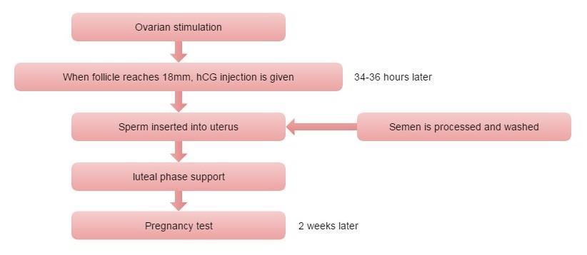 IUI - Διαδικασία Clomifen, gonadotrophins Sperm