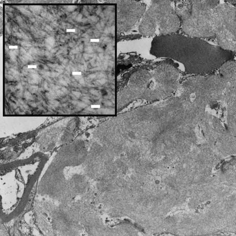 Formalin-fixed tissue sections gave similar distribution of staining but was less intense. Original magnification 100.