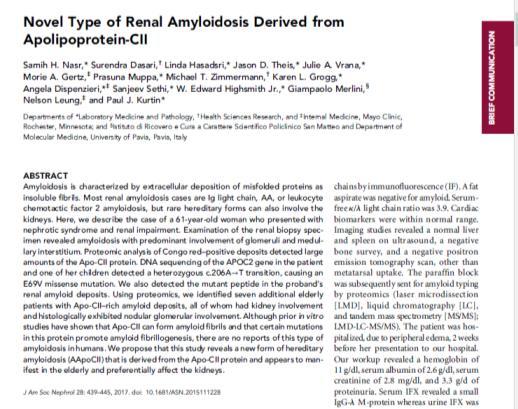 ΑΜΥΛΟΕΙΔΩςΗ ΑΠΟΛΙΠΟΠΡΩΤΕΪΝΗς CΙΙ Προσφάτως περιγραφείσα (Νasr et al, JASN 2017) Ετερόζυγες μεταλλάξεις στο γονίδιο ΑpoCII Σπειραματική
