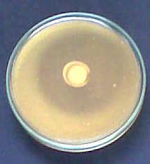 monocytogenes