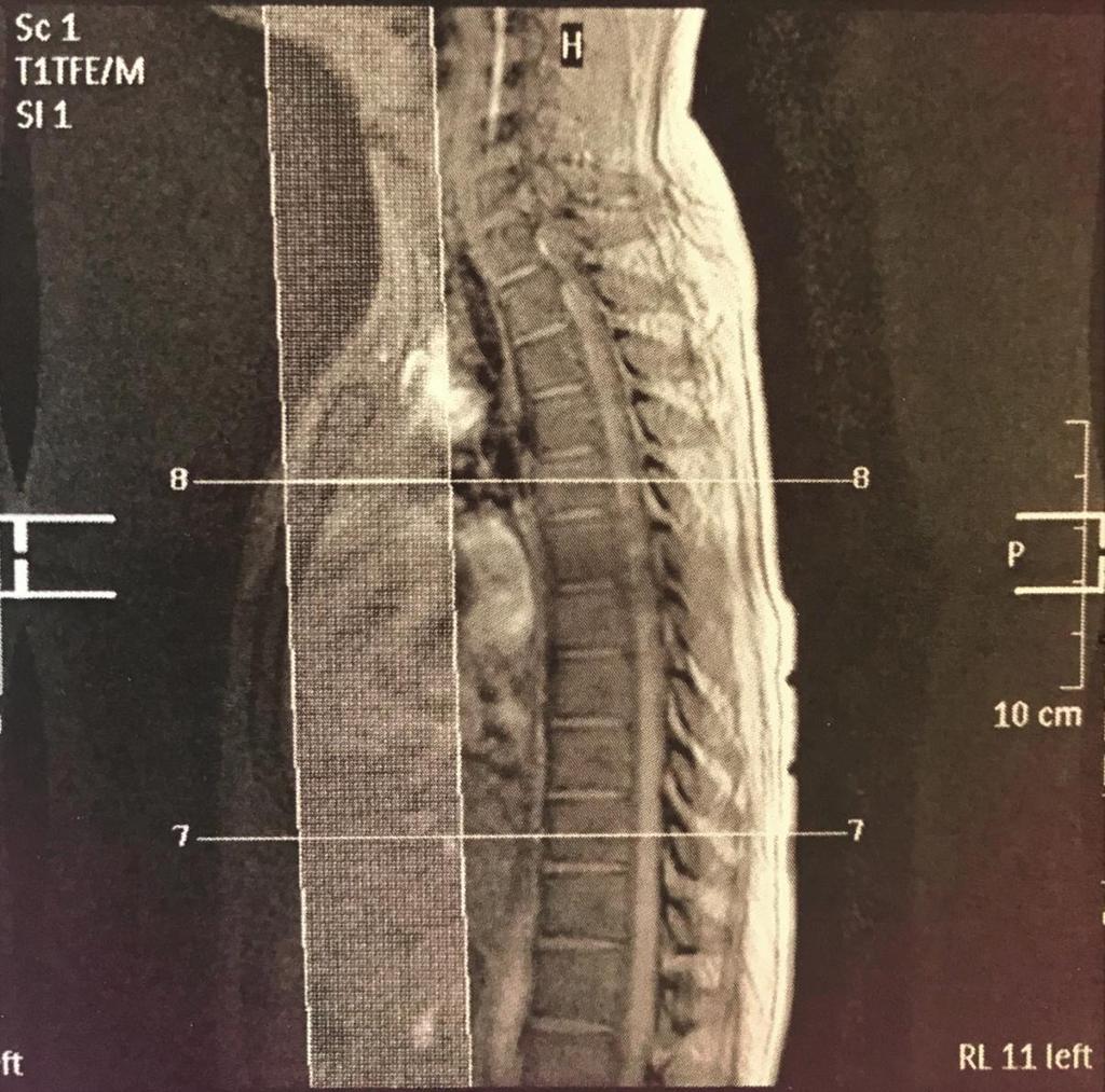 Νέα MRI ΣΣ (2015)