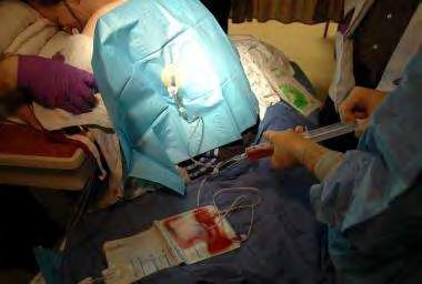 Ημερομηνία πρόσβασης 26/07/2015 από: http://emedicine.medscape.