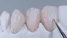 IPS Style Ceram