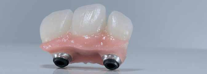Gingiva (G5) Basic