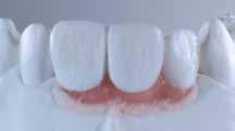 IPS Style Ceram Gingiva