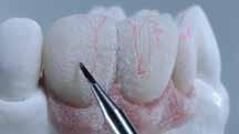 IPS Style Ceram Gingiva