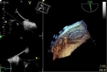 Cardiovascular Imaging