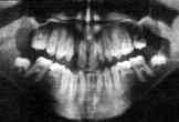 DENTAL TRIBUNE Greek Edition Τάσεις & εφαρµογές 31 DT σελίδα 30 Περίληψη Η οµαδική εργασία είναι βασική για την αντι- µετώπιση της µερικής ανοδοντίας.