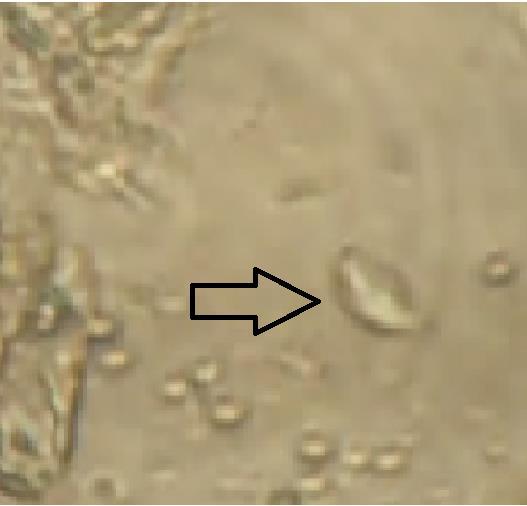 Trichomonas gallinae المسحة الرطبة A=slender axostyle(posterior end),b=pear-shaped body تم عزل الطفيلي من المسحة الرطبة المأخوذة من الفم والحوصلة للطيور المصابة وأجرت لها فحوصات ألمختبريه بحسب طريقة