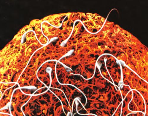 Σπερματοζωάρια πολιορκούν ωάριο (φωτογραφία από