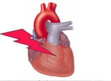 Τα mirnas θεραπευτικά στην CVD mirn A mimics