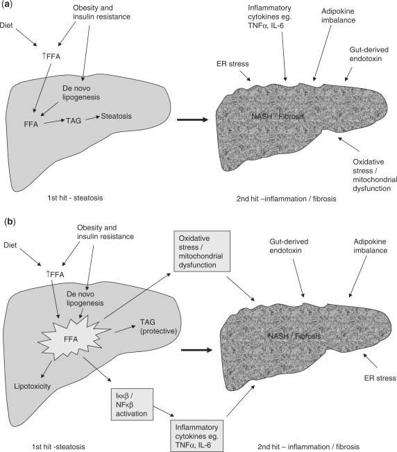 ΚΕΦΑΛΑΙΟ 4 ο ΠΑΘΟΦΥΣΙΟΛΟΓΙΑ NAFLD - NASH Η Θεωρία του «Διπλού Χτυπήματος» Από την πρώτη περιγραφή της νόσου το 1980 από τους Ludwig et al η παθογένεια της NAFLD παραμένει