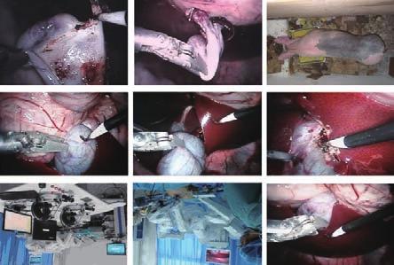 [3] Ginhoux R, Gangloff J, de Mathelin M, et al. Active filtering of physiological motion in robotized surgery using predictive control[j]. IEEE Transactions on Robotics, 5, 21(1): 67-79.