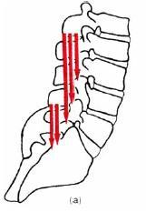 Πολυσχιδής Norris, C. M. (1995). "Spinal Stabilization. 3.