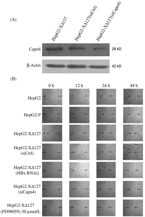 with 30 μmol / L or 50 μmol / L PD98059 an inhibitor of ERK for 2 hours The results were representative of three independent experiments 3 HBV Capn4 were decreased when HepG2-XΔ127 cells were treated