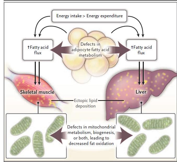Ectopic Fat in Insulin Resistance, Dyslipidemia, and