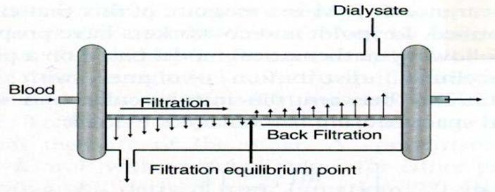 BACKFILTRATION Δεν υπάρχουν ενδείξεις για αυξημένη διαπερατότητα ενδοτοξινών και επιμόλυνση στο αιματικό διαμέρισμα του φίλτρου, όπως προκύπτει απο πειρατικά μοντέλα Schepers E, Glorieux G, Eloot S,